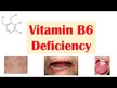Видео обзор на Витамин B-6 200 мг, Vitamin B-6 200 mg, 90 капсул