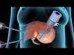Відео огляд на Organic Liver & Gallbladder, Підтримка печінки, 90 г