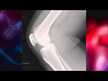 Відео огляд на Flex Able Advanced Includes Glucosamine Bioactive, Колаген, 90 ка