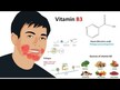 Відео огляд на Niacinamide B-3 Timed Release 1500 mg, Ніацинамід, 100 таблеток